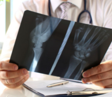 Radiografía de Extremidades