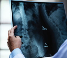 Radiografía Renales